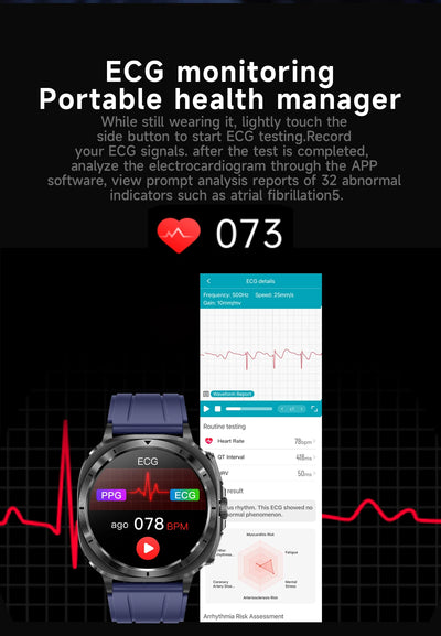 Xiaomi 2025 Health Smartwatch with ECG+PPG & Body Analysis